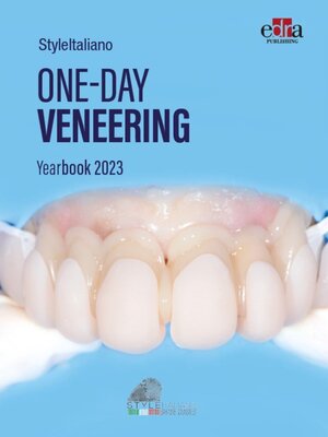 cover image of One-day Veneering